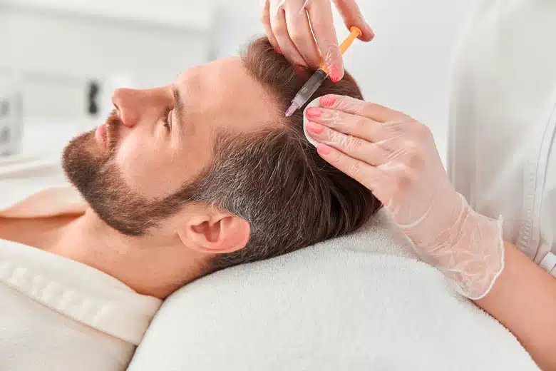 Tratamiento capilar - Mesoterapia capilar - Eternal Hair Clinic Barcelona - 02