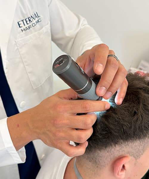 Diagnóstico capilar previo a la mesoterapia capilar con vitaminas en Eternal Hair Clinic Barcelona